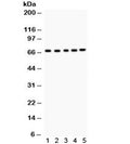 Western blot testing of 1) rat kidney, 2) mouse liver, 3) human HeLa, 4) PANC and 5) COLO320 lysate with ACHE antibody. Expected/observed molecular weight ~67 kDa.