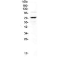 Western blot testing of human HepG2 cell lysate with PROS1 antibody at 0.5ug/ml. Predicted molecular weight ~75 kDa.