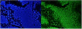 Immunofluorescent staining of FFPE human intestinal cancer with AUF1 antibody (green) and DAPI nuclear stain (blue). HIER: steam section in pH6 citrate buffer for 20 min.