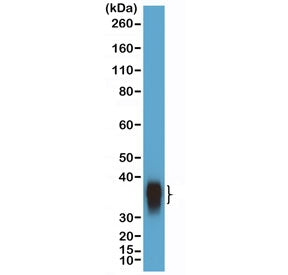 Western blot testing of human Daudi cell lysate with recombinant BOB-1 antibody at 1:10,000 dilution. Predicted molecular weight: ~28 kDa (unmodified), 35-40 kDa (ubiquitinated).