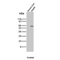 AFP Antibody Human Liver and HepG2 WB. Western blot analysis of human liver and HepG2 cell lysates using AFP Antibody (clone MBS-12) detects a band at approximately 65-70 kDa in HepG2 cells, consistent with the expected molecular weight of Alpha fetoprotein. No band is observed in adult human liver lysate, reflecting the known suppression of AFP expression in normal adult liver and its re-expression in hepatocellular carcinoma-derived cells.