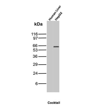 AFP Antibody Human Liver and HepG2 WB. Western blot analysis of human liver and HepG2 cell lysates using AFP Antibody (clone MBS-12) detects a band at approximately 65-70 kDa in HepG2 cells, consistent with the expected molecular weight of Alpha fetoprotein. No band is observed in adult human liver lysate, reflecting the known suppression of AFP expression in normal adult liver and its re-expression in hepatocellular carcinoma-derived cells.