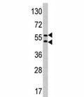 Western blot analysis of CA9 antibody and HeLa lysate. Predicted molecular weight: 58 kDa and 54 kDa (soluble form).