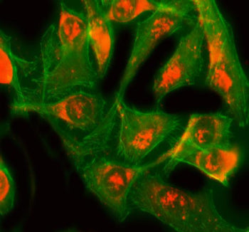 Immunofluorescent staining of GINS3 using anti-GINS3 antibody (red) and anti-Tubulin mAb (green). GINS3 was detected in an immunocytochemical section of Hela cells. Enzyme antigen retrieval was performed using IHC enzyme antigen retrieval reagent for 15 mins. The cells were blocked with 10% goat serum. And then incubated with 5 ug/ml rabbit anti-GINS3 antibody overnight at 4oC. DyLight 594 Conjugated Goat Anti-Rabbit IgG was used as secondary antibody at 1:100 dilution and incubated for 30 min at 37oC.