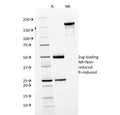 SDS-PAGE analysis of purified, BSA-free IgM antibody (clone IGHM/1623) as confirmation of integrity and purity.
