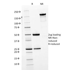 SDS-PAGE analysis of purified, BSA-free IgM antibody (clone IGHM/1623) as confirmation of integrity and purity.