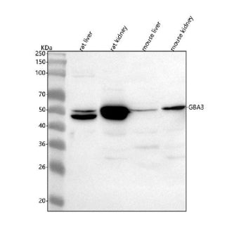 Western blot analysis of GBA3 using anti-GBA3 antibody. Lane 1: rat liver tissue lysates, Lane 2: rat kidney tissue lysates, Lane 3: mouse liver tissue lysates, Lane 4: mouse kidney tissue lysates. After electrophoresis, proteins were transferred to a nitrocellulose membrane at 150 mA for 50-90 min. Blocked the membrane with 5% non-fat milk/TBS for 1.5 hour at RT.
