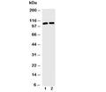 Western blot with TRIF antibody and Lane 1: Jurkat; 2: HL-60 cell lysate. Predicted/observed molecular weight: 76/70-150kDa.