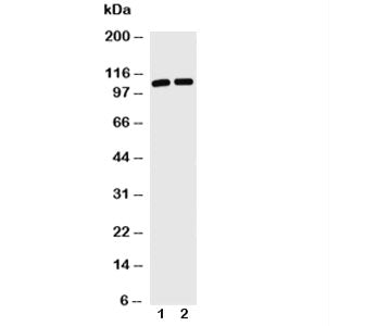 Western blot with TRIF antibody and Lane 1: Jurkat; 2: HL-60 cell lysate. Predicted/observed molecular weight: 76/70-150kDa.
