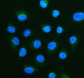 Immunofluorescent staining of FFPE human A549 cells with PMP70 antibody (green) and DAPI nuclear stain (blue). HIER: steam section in pH6 citrate buffer for 20 min.