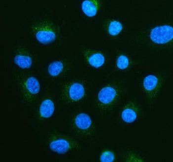 Immunofluorescent staining of FFPE human A549 cells with PMP70 antibody (green) and DAPI nuclear stain (blue). HIER: steam section in pH6 citrate buffer for 20 min.