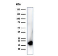 Western blot testing of human HepG2 cell lysate using CDKN2A antibody (clone rCDKN2A/4845). Predicted molecular weight ~16 kDa.