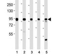 Western blot testing of EZH2 antibody at 1:2000 dilution. Lane 1: Jurkat lysate; 2: MDA-MB-231 lysate; 3: MDA-MB-468 lysate; 4: T47D lysate; 5: mouse spleen lysate; Predicted molecular weight: 85-95 kDa.