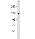 Western blot testing of human brain lysate with ACK1 antibody at 1:1000. Predicted molecular weight ~114 kDa.