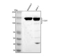 Western blot analysis of CD21/CR2 using anti-CD21 antibody. Lane 1: mouse Raw264.7 whole cell lysates, Lane 2: mouse Ana-1 whole cell lysates. After electrophoresis, proteins were transferred to a nitrocellulose membrane at 150 mA for 50-90 minutes. Blocked the membrane with 5% non-fat milk/TBS for 1.5 hour at RT. The membrane was incubated with rabbit anti-CD21 antibody at 0.5 ug/ml overnight at 4oC, then washed with TBS-0.1%Tween 3 times with 5 minutes each and probed with a goat anti-rabbit IgG-HRP secon