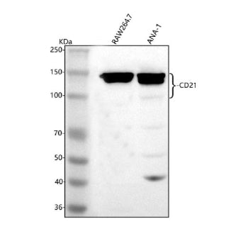 Western blot analysis of CD21/CR2 using anti-CD21 antibody. Lane 1: mouse Raw264.7 whole cell lysates, Lane 2: mouse Ana-1 whole cell lysates. After electrophoresis, proteins were transferred to a nitrocellulose membrane at 150 mA for 50-90 minutes. Blocked the membrane with 5% non-fat milk/TBS for 1.5 hour at RT. The membrane was incubated with rabbit anti-CD21 antibody at 0.5 ug/ml overnight at 4oC, then washed with TBS-0.1%Tween 3 times with 5 minutes each and probed with a goat anti-rabbit IgG-HRP secon