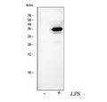 Western blot testing of lysate from mouse RAW264.7 cells untreated and treated with LPS using IL1 beta antibody. Predicted molecular weight ~31 kDa.