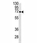 Western blot analysis of CDC25B antibody and Ramos lysate. Expected/observed molecular weight: 61~67kDa (isoforms 1-4).