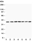 Western blot testing of MEK3 antibody and Lane 1: rat skeletal muscle; 2: rat kidney; 3: rat spleen; and human samples 4: HeLa; 5: A549; 6: Jurkat; 7: CEM; Predicted size: 39KD; Observed size: 39KD