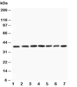 Western blot testing of MEK3 antibody and Lane 1: rat skeletal muscle; 2: rat kidney; 3: rat spleen; and human samples 4: HeLa; 5: A549; 6: Jurkat; 7: CEM; Predicted size: 39KD; Observed size: 39KD