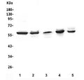 Western blot testing of 1) human Jurkat, 2) rat thymus, 3) rat spleen, 4) mouse thymus and 5) mouse spleen lysate with LCK antibody. Expected/observed molecular weight ~58 kDa.