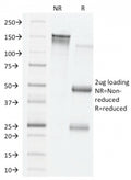 SDS-PAGE analysis of purified, BSA-free VEGF antibody (clone VG76e) as confirmation of integrity and purity.