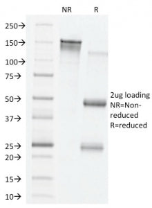 SDS-PAGE analysis of purified, BSA-free VEGF antibody (clone VG76e) as confirmation of integrity and purity.