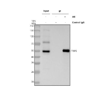 Immunoprecipitating TRIP6 in Hela whole cell lysate. Western blot analysis of TRIP6 using anti-TRIP6 antibody. Lane 1: Hela whole cell lysates (30ug), Lane 2: Rabbit control IgG instead of anti-TRIP6 antibody in Hela whole cell lysate, Lane 3: anti-TRIP6 antibody (2ug) + Hela whole cell lysate (500ug). After electrophoresis, proteins were transferred to a membrane.