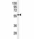 Glypican 3 antibody western blot analysis in mouse stomach tissue lysate