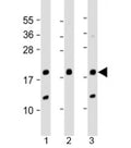 Western blot testing of human 1) A431, 2) SK-BR-3 and 3) U-2OS cell lysate with THRSP antibody at 1:2000. Predicted molecular weight: 17 kDa.