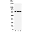 Western blot testing of IRAKM antibody and Lane 1: HeLa; 2: Jurkat; 3: HUT102 cell lysate. Predicted molecular weight: ~68kDa.