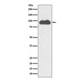 Western blot testing of human HeLa cell lysate with TRFC antibody. Predicted molecular weight: 85-95 kDa.