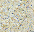 Immunohistochemical staining of SNCA using anti-SNCA antibody. SNCA was detected in a paraffin-embedded section of mouse brain tissue. Heat mediated antigen retrieval was performed in EDTA buffer (pH 8.0, epitope retrieval solution). The tissue section was blocked with 10% goat serum. The tissue section was then incubated with 2 ug/ml rabbit anti-SNCA antibody overnight at 4oC. Peroxidase Conjugated Goat Anti-rabbit IgG was used as secondary antibody and incubated for 30 min at 37oC.