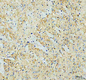 Immunohistochemical staining of SNCA using anti-SNCA antibody. SNCA was detected in a paraffin-embedded section of mouse brain tissue. Heat mediated antigen retrieval was performed in EDTA buffer (pH 8.0, epitope retrieval solution). The tissue section was blocked with 10% goat serum. The tissue section was then incubated with 2 ug/ml rabbit anti-SNCA antibody overnight at 4oC. Peroxidase Conjugated Goat Anti-rabbit IgG was used as secondary antibody and incubated for 30 min at 37oC.