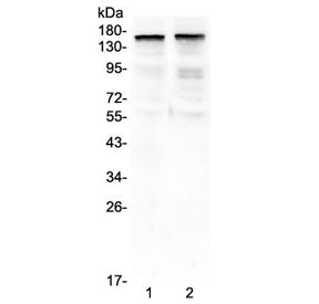 Western blot analysis of 1) rat brain and 2) mouse brain tissue lysates using THBS2 antibody. The expected molecular weight for full-length THBS2 is approximately 130 kDa, but literature reports fully glycosylated forms migrating at 140-170 kDa. In this blot, the major band appears near ~160 kDa, consistent with mature glycosylated THBS2. A secondary banding at ~90 kDa corresponds to documented proteolytic fragments described for this extracellular matrix protein.