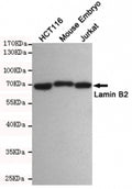 Western blot testing of 1) human HCT116, 2) mouse embryo and 3) human Jurkat cell lysates using Lamin B2 antibody at 1:500. Predicted molecular weight ~70 kDa.