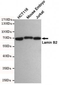 Western blot testing of 1) human HCT116, 2) mouse embryo and 3) human Jurkat cell lysates using Lamin B2 antibody at 1:500. Predicted molecular weight ~70 kDa.