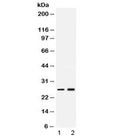 Western blot testing of 1) rat testis and 2) human MCF7 lysate with PSMA2 antibody at 0.5ug/ml. Predicted/observed molecular weight ~26 kDa.