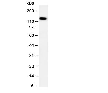 Western blot testing of PTCH2 antibody and human HeLa cell lysate. Expected molecular weight ~130 kDa.