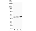Western blot testing of TNFAIP1 antibody and Lane 1: rat thymus; 2: HeLa; 3: COLO320; Predicted size: 36KD; Observed size: 36KD