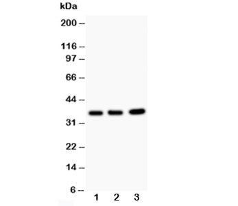 Western blot testing of TNFAIP1 antibody and Lane 1: rat thymus; 2: HeLa; 3: COLO320; Predicted size: 36KD; Observed size: 36KD