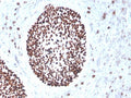 IHC staining of FFPE human cervix with recombinant SOX2 antibody (clone rSOX2/1791). HIER: boil tissue sections in pH 9 10mM Tris with 1mM EDTA for 10-20 min and allow to cool before testing.