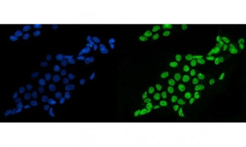 Immunofluorescent staining of FFPE human A431 cells with Splicing factor 1 antibody (green) and DAPI nuclear stain (blue). HIER: steam section in pH6 citrate buffer for 20 min.