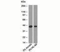 Western blot testing of human samples with RUNX3 antibody at 2 ug/ml. Predicted molecular weight: ~44 kDa, isoforms can be observed at 42-48 kDa.