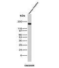 CD66 Antibody Intestine WB. Western blot analysis of CD66 / CEA (CEACAM5) expression in human intestine tissue lysate using CD66 antibody, clone C66/2055R. Lane 1: human intestine tissue lysate. A strong band is detected at approximately 180-200 kDa, consistent with the predicted molecular weight of CEACAM5, with the elevated apparent size reflecting extensive glycosylation characteristic of this epithelial cell surface glycoprotein.