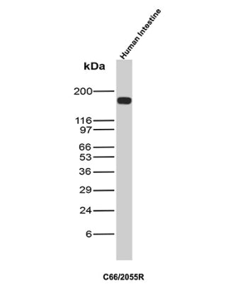 CD66 Antibody Intestine WB. Western blot analysis of CD66 / CEA (CEACAM5) expression in human intestine tissue lysate using CD66 antibody, clone C66/2055R. Lane 1: human intestine tissue lysate. A strong band is detected at approximately 180-200 kDa, consistent with the predicted molecular weight of CEACAM5, with the elevated apparent size reflecting extensive glycosylation characteristic of this epithelial cell surface glycoprotein.