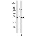Western blot testing of human 1) kidney and 2) liver lysate with Sclerostin antibody. Predicted molecular weight ~24 kDa.