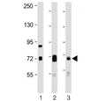 Western blot testing of DLL4 antibody at 1:1000: Lane 1) mouse kidney, 2) mouse lung and 3) rat lung lysate. Predicted molecular weight ~75 kDa.