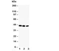 Western blot testing of CCR6 antibody and Lane 1: rat liver; 2: human SW620; 3: human CEM cell lysate.