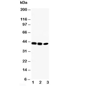 Western blot testing of CCR6 antibody and Lane 1: rat liver; 2: human SW620; 3: human CEM cell lysate.